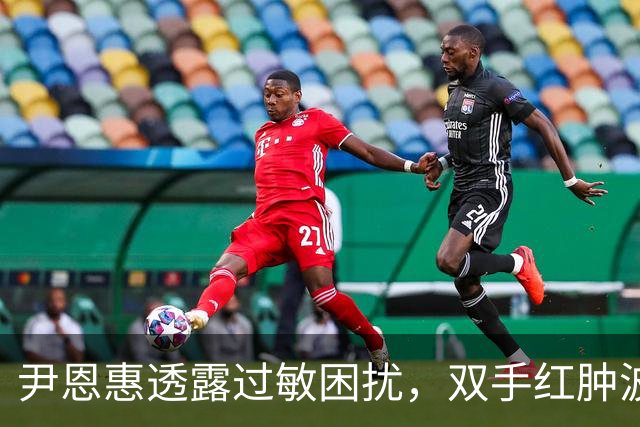 尹恩惠透露过敏困扰，双手红肿波及全脸失眠难忍